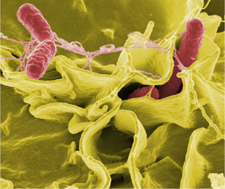 This color-enhanced photo shows Salmonella typhimurium (red) attacking human cells. 